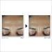 RoC Retinol Correxion Anti-Wrinkle Retinol Face Serum with Hyaluronic Acid 1.0 oz - Transform Your Style with the Best Innovation Today! - Buy Online on GoSupps.com