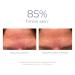 Discover DERMA E Stem Cell Eye Lifting Treatment with Copper Peptides 0.5 oz - Elevate Your Style Instantly! - Buy Online on GoSupps.com