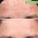 Murad Retinol Youth Renewal Serum 1.0 oz - Transform Your Style with the Best Innovation Today! - Buy Online on GoSupps.com