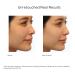 Discover Murad Outsmart Acne Clarifying Treatment 1.7 oz - Elevate Your Style Instantly! - Buy Online on GoSupps.com