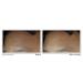 RoC Retinol Correxion Max Daily Hydration Creme Fragrance-Free - Discover Premium Quality Shop now! - Buy Online on GoSupps.com