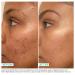 Urban Skin Rx Even Tone Cleansing Bar 3-in-1 Treatment 2.0 oz - Transform Your Style with the Best Innovation Today! - Buy Online on GoSupps.com