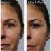 Murad Rapid Collagen Infusion Instant Plumping Treatment 1.0 oz - Discover Premium Quality Shop now! - Buy Online on GoSupps.com