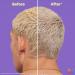 Matrix So Silver Triple Power Hair Mask 6.8 oz - Transform Your Style with the Best Innovation Today! - Buy Online on GoSupps.com