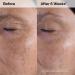 Discover The Ordinary Travel Size Glycolic Acid 7% Exfoliating Toner 3.38 oz - Elevate Your Style Instantly! - Buy Online on GoSupps.com