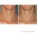 Exuviance Age Reverse Antiaging Toning Neck Cream 4.40 oz - Discover Premium Quality Shop now! - Buy Online on GoSupps.com