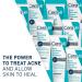 CeraVe Acne Foaming Cream Cleanser with 4% BPO for Acne Prone Skin 5.0 oz - Transform Your Style with the Best Innovation Today! - Buy Online on GoSupps.com