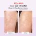 Discover First Aid Beauty KP Bump Eraser Body Scrub with 10% AHA Original - Elevate Your Style Instantly! - Buy Online on GoSupps.com
