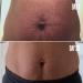 Discover MAÃ‹LYS B-FLAT Belly Firming Cream 3.38 oz - Elevate Your Style Instantly! - Buy Online on GoSupps.com