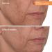 Murad Vitamin C Glycolic Brightening Serum 1.0 oz - Transform Your Style with the Best Innovation Today! - Buy Online on GoSupps.com