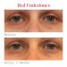 Murad Vitamin C Dark Circle Correcting Eye Serum 0.5 oz - Transform Your Style with the Best Innovation Today! - Buy Online on GoSupps.com