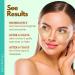 Patchology Moodpatch Chill Mode Soothing Eye Gels 5 ct - Transform Your Style with the Best Innovation Today! - Buy Online on GoSupps.com
