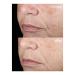 Discover Dermalogica Retinol Acne Clearing Oil 1.0 oz - Elevate Your Style Instantly! - Buy Online on GoSupps.com