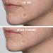 Discover First Aid Beauty FAB Pharma BHA Acne Spot Treatment 0.75 oz - Elevate Your Style Instantly! - Buy Online on GoSupps.com