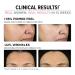 IT Cosmetics Hello Results Wrinkle-Reducing Daily Retinol Serum-in-Cream 1.7 oz - Transform Your Style with the Best Innovation Today! - Buy Online on GoSupps.com