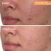Murad Rapid Dark Spot Correcting Serum 1.0 oz - Discover Premium Quality Shop now! - Buy Online on GoSupps.com