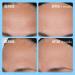 First Aid Beauty Firming Cream with Peptides, Niacinamide + Collagen 1.7 oz - Transform Your Style with the Best Innovation Today! - Buy Online on GoSupps.com