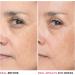 Discover IT Cosmetics Bye Bye Lines Hyaluronic Acid Serum - Elevate Your Style Instantly! - Buy Online on GoSupps.com