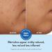 Peach Slices Acne Clarifying Cleanser 4.0 oz - Transform Your Style with the Best Innovation Today! - Buy Online on GoSupps.com