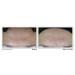 RoC Multi Correxion Hyaluronic Acid Daily Moisturizer SPF 30 1.7 oz - Transform Your Style with the Best Innovation Today! - Buy Online on GoSupps.com