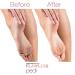 Flawless by Finishing Touch Flawless Pedi Electronic Tool File and Callus Remover - Discover Premium Quality Shop now! - Buy Online on GoSupps.com