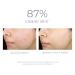 Discover DERMA E Anti-Acne Oil-Control Matte Moisturizer with Salicylic Acid 2.0 oz - Elevate Your Style Instantly! - Buy Online on GoSupps.com