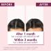 Discover Klorane Strengthening Serum with Quinine and Edelweiss 3.3 oz - Elevate Your Style Instantly! - Buy Online on GoSupps.com