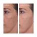 Murad Travel Size Rapid Dark Spot Correcting Serum - Discover Premium Quality Shop now! - Buy Online on GoSupps.com