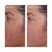 Murad Travel Size Rapid Dark Spot Correcting Serum - Discover Premium Quality Shop now! - Buy Online on GoSupps.com