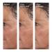 Discover Murad Targeted Wrinkle Corrector Treatment 0.5 oz - Elevate Your Style Instantly! - Buy Online on GoSupps.com