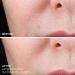 Discover BeautyBio Get That Glow GloPRO Facial Microneedling Discovery Set - Elevate Your Style Instantly! - Buy Online on GoSupps.com
