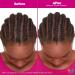 Matrix Total Results Instacure Tension Reliever Scalp Serum 6.7 oz - Transform Your Style with the Best Innovation Today! - Buy Online on GoSupps.com