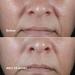 Discover Clinique Clinique Smart Clinical Repair Wrinkle Correcting Rich Face Cream 1.7 oz - Elevate Your Style Instantly! - Buy Online on GoSupps.com