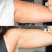 MAÃ‹LYS B-FLEX Lift & Firm Arm Cream 3.38 oz - Transform Your Style with the Best Innovation Today! - Buy Online on GoSupps.com