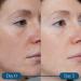 Discover ELEMIS Dynamic Resurfacing Super-C Serum 0.50 oz - Elevate Your Style Instantly! - Buy Online on GoSupps.com