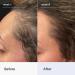 Discover Better Not Younger Superpower+ Advanced Hair Densifying Scalp Serum 2.0 oz - Elevate Your Style Instantly! - Buy Online on GoSupps.com