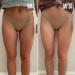 Discover MAÃ‹LYS B-FOXY Inner Thigh Firming Cream 3.38 oz - Elevate Your Style Instantly! - Buy Online on GoSupps.com