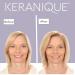 Discover Keranique Volumizing Follicle Strengthening Conditioner 8.0 oz - Elevate Your Style Instantly! - Buy Online on GoSupps.com