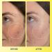 Kinship Brightwave 10% Vitamin C + Peptide Brightening Serum 1.0 oz - Transform Your Style with the Best Innovation Today! - Buy Online on GoSupps.com