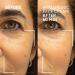 Discover Dr. Brandt Needles No More Hyaluronic Face Cream 1.7 oz - Elevate Your Style Instantly! - Buy Online on GoSupps.com