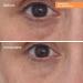Discover Murad Targeted Eye Depuffer Treatment 0.5 oz - Elevate Your Style Instantly! - Buy Online on GoSupps.com
