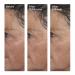 Murad 5 Minute Fix: Targeted Correctors Set - Discover Premium Quality Shop now! - Buy Online on GoSupps.com