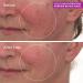 Discover Murad Cellular Hydration Barrier Repair Mask 2.7 oz - Elevate Your Style Instantly! - Buy Online on GoSupps.com