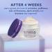 Discover Peter Thomas Roth Ultimate Solution 5 Multitasking Eye Cream - Elevate Your Style Instantly! - Buy Online on GoSupps.com