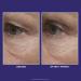 Discover Peter Thomas Roth Ultimate Solution 5 Multitasking Eye Cream - Elevate Your Style Instantly! - Buy Online on GoSupps.com