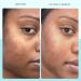 Discover First Aid Beauty Facial Radiance Niacinamide Dark Spot Serum 1.0 oz - Elevate Your Style Instantly! - Buy Online on GoSupps.com