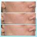 Discover First Aid Beauty Facial Radiance Niacinamide Dark Spot Serum 1.0 oz - Elevate Your Style Instantly! - Buy Online on GoSupps.com