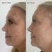 Discover DIME Dark Spot Corrector 1.7 oz - Elevate Your Style Instantly! - Buy Online on GoSupps.com