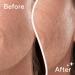 Flawless by Finishing Touch Dermaplane Glo Sonic Lighted Facial Exfoliator - Transform Your Style with the Best Innovation Today! - Buy Online on GoSupps.com