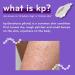 Discover AmLactin KP Bumps Be Gone Cream with 15% Lactic Acid AHA 3.0 oz - Elevate Your Style Instantly! - Buy Online on GoSupps.com